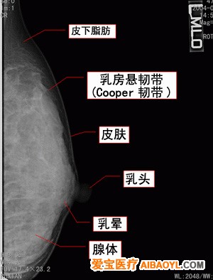 认识乳腺钼靶照片 - 马夫 - 马夫的博客