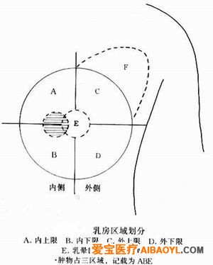 认识乳腺钼靶照片 - 马夫 - 马夫的博客