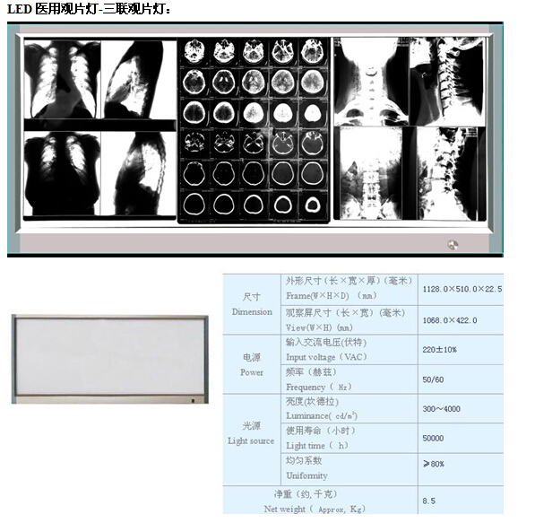 新型LED观片灯 单联 双联 三联  四联9