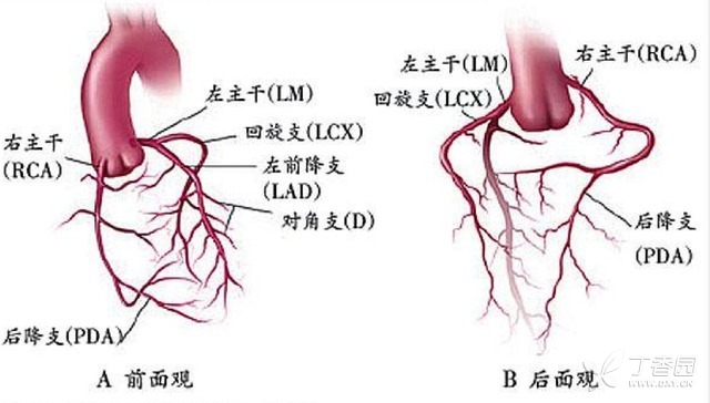 急性 ST 段抬高型心梗：手把手教你判断罪犯血管