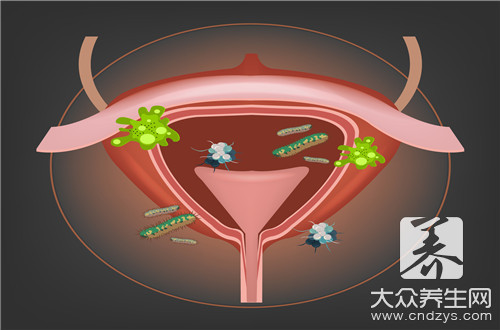 急性膀胱炎应该用什么药?