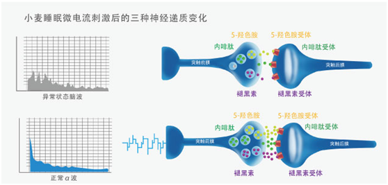 小麦睡眠治失眠物理疗法，经颅微电流刺激告别失眠！